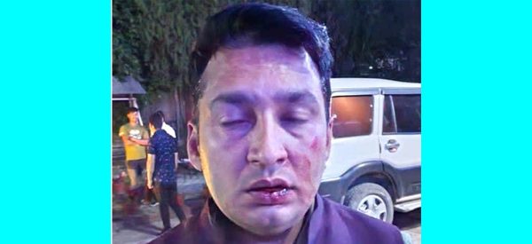 नमोबुद्ध नगरपालिकाका कांग्रेसबाट मेयरका दाबेदार पाण्डे कुटिए