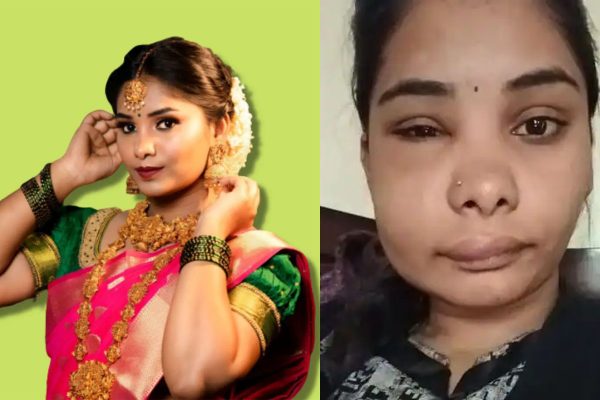 सर्जरीपछि अभिनेत्री स्वातिको अनुहारको स्वरूप नै बिग्रियो