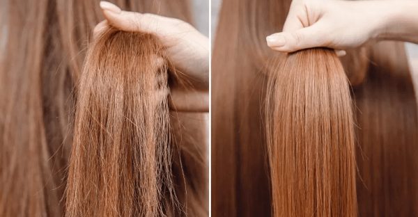 सुख्खा कपाललाई राम्रो बनाउने घरेलु तरिका