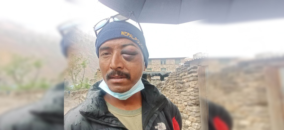 इन्स्पेक्टरको कुटाइबाट हवल्दारको आँखा सुन्नियो, नाकको डाँडी भाँचियो