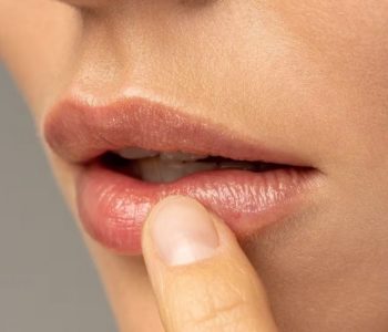 ओंठको कालोपन हटाउने घरेलु तरिका