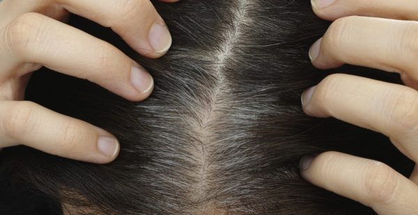के तपाईंको पनि समयअघि नै कपाल फूल्न थाल्यो ? कारण जान्नुहोस्