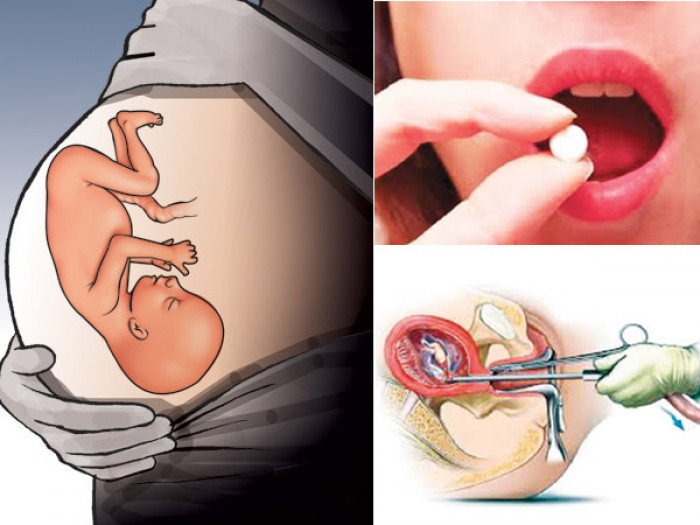 जापानमा चिकित्सकको प्रेस्क्रिप्सनबिना गर्भनिरोधक चक्की बिक्री गर्ने पाइलट प्रोजेक्ट सुरु