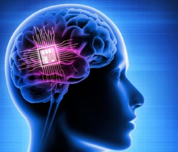 मस्तिष्कमा चिप प्रत्यारोपण गर्न मस्कले पाए स्वीकृति, सोच अनुसार कम्प्युटर चल्ने 