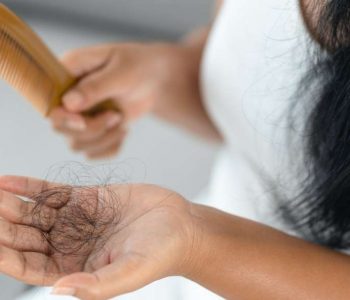 एक दिनमा कति कपाल झर्नु सामान्य हो ?
