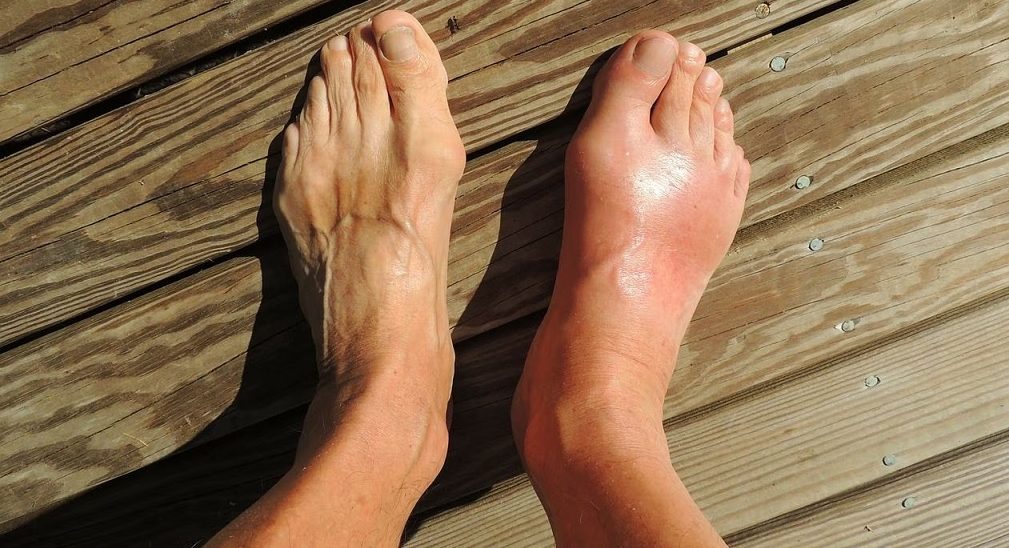 गेस्टहाउसमा मृत भेटिए २१ वर्षे युवा, के थियो कारण ?