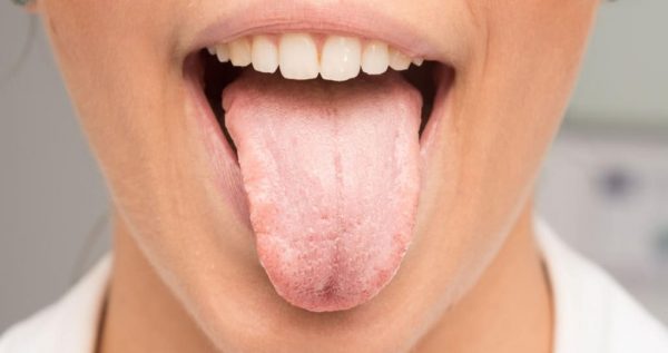 मुख सुख्खा के कारणले हुन्छ ?