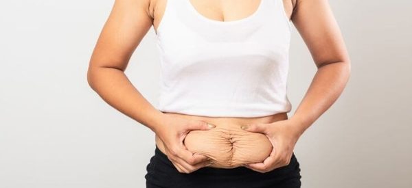 डेलिभरीपछि झुन्डिएको पेट घटाउन अपनाउनुहोस् यी उपाय