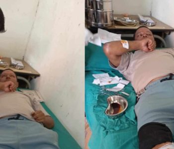 कालोपुलमा ढुङ्गा प्रहारबाट महानगरका कर्मचारी घाइते