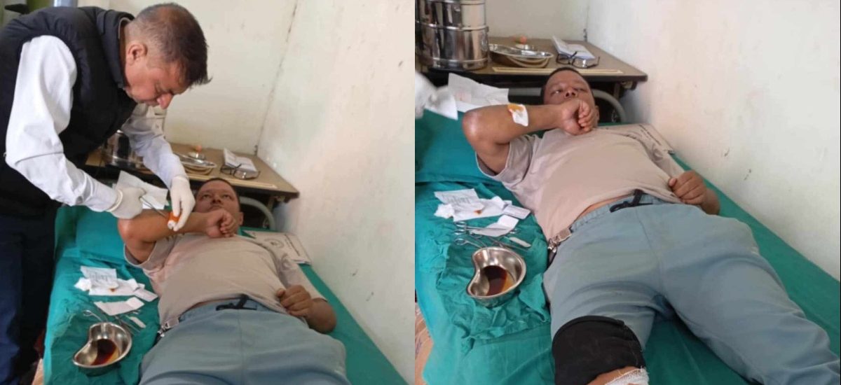 कालोपुलमा ढुङ्गा प्रहारबाट महानगरका कर्मचारी घाइते
