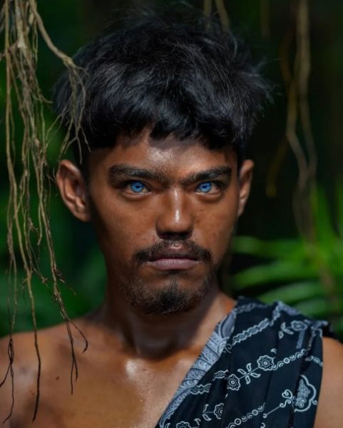 नीलो आँखा सौन्दर्यको वरदान कि शारीरिक समस्या ?