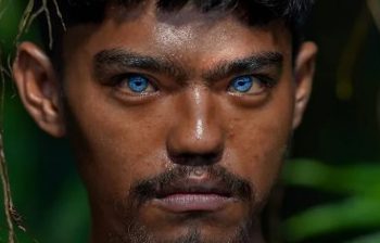 नीलो आँखा सौन्दर्यको वरदान कि शारीरिक समस्या ?
