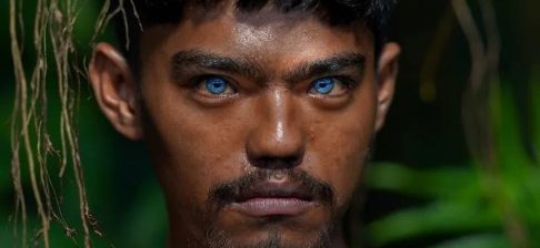 नीलो आँखा सौन्दर्यको वरदान कि शारीरिक समस्या ?