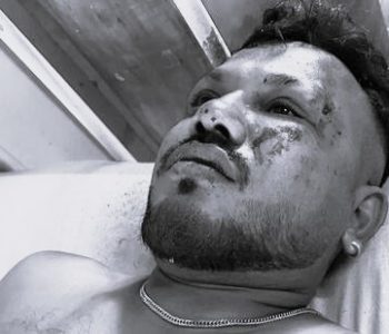 एयर इन्डिया विमान दुर्घटनाबाट बाँच्न सफल यात्रुले भने– उडेको ३० सेकेन्डमै समस्या सुरु भयो
