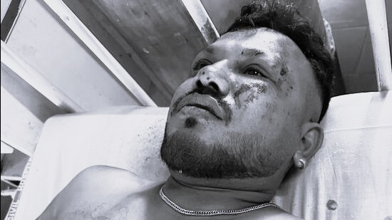 एयर इन्डिया विमान दुर्घटनाबाट बाँच्न सफल यात्रुले भने– उडेको ३० सेकेन्डमै समस्या सुरु भयो